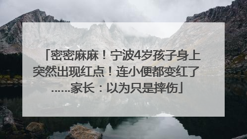 密密麻麻！宁波4岁孩子身上突然出现红点！连小便都变红了……家长：以为只是摔伤